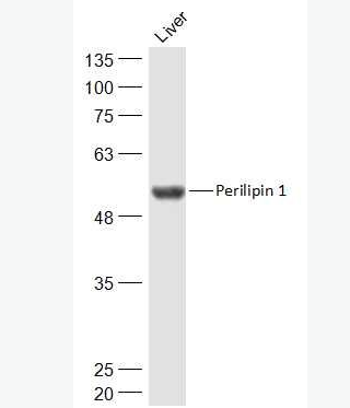 Anti-Perilipin 1 antibody-脂滴包被蛋白Perilipin-A抗体