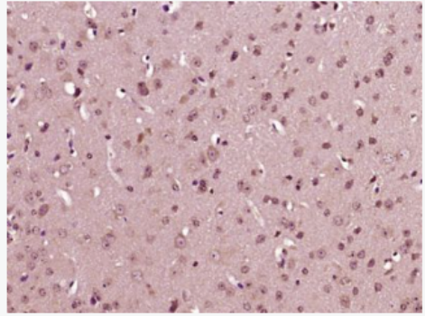 Anti-IL23 P19 antibody-白细胞介素23P19抗体