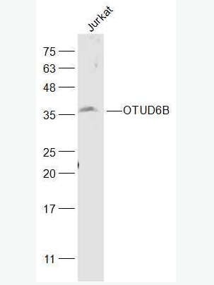 Anti-OTUD6B antibody-OTUD6B蛋白抗体