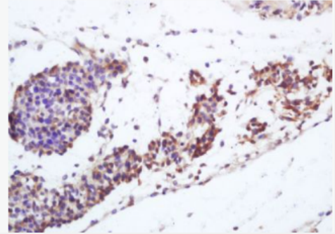 Anti-Vitamin D Receptor  antibody-维生素D3受体抗体