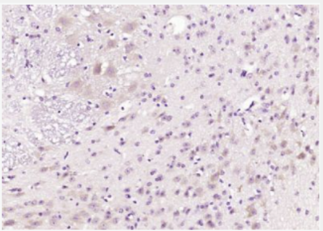 Anti-FKBP1B antibody-FKBP1B/FKBP9蛋白抗体