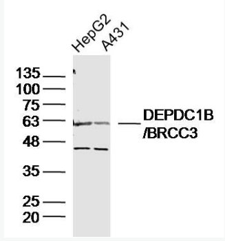 Anti-DEPDC1B/BRCC3 antibody-乳腺癌细胞3抗体