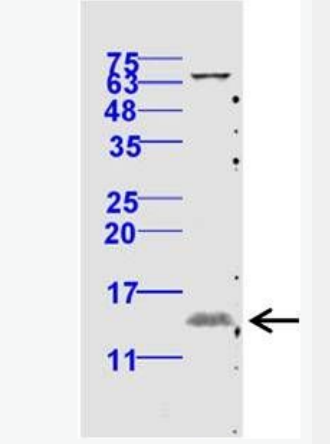 Anti-phospho-eIF4EBP1（Thr70） antibody-磷酸化eIF4E结合蛋白抗体