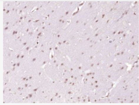 Anti-TBX3 antibody-转录因子Tbx3抗体