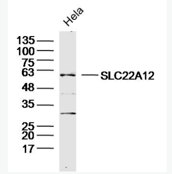 Anti-SLC22A12 antibody-尿酸盐重吸收转运子1抗体