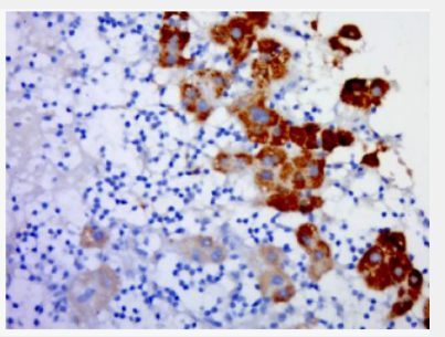 Anti-GPR37 antibody-G蛋白偶联受体37/帕金森相关内皮素受体样受体抗体