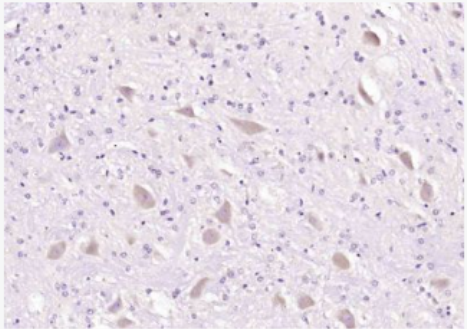 Anti-APOD antibody-载脂蛋白D抗体