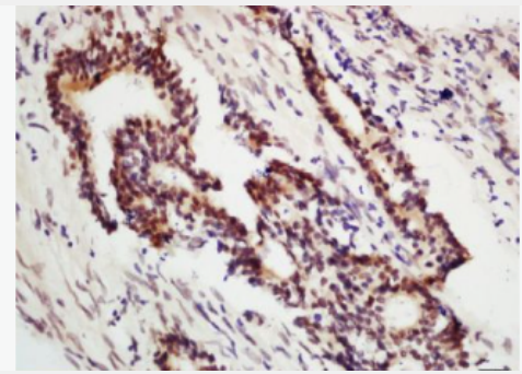 Anti-POLG antibody-DNA聚合酶γ/DNA pol γ抗体