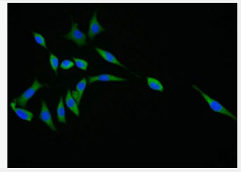 Anti-Smac antibody-线粒体促凋亡蛋白抗体