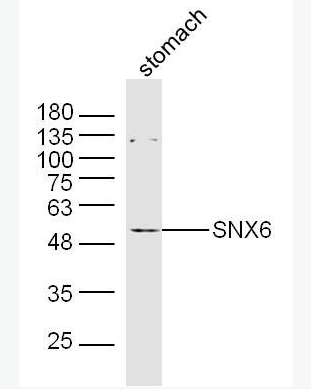 Anti-SNX6 antibody-分选连接蛋白6抗体