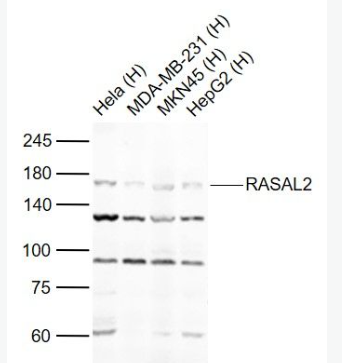 Anti-RASAL2 antibody-RASAL2蛋白抗体