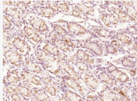 Anti-CCL27 antibody-皮肤T细胞虏获趋化因子抗体