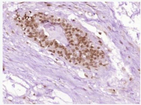 Anti-STAT3  antibody-信号转导和转录激活因子3抗体