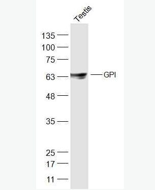 Anti-GPI antibody-糖磷脂酰肌醇抗体