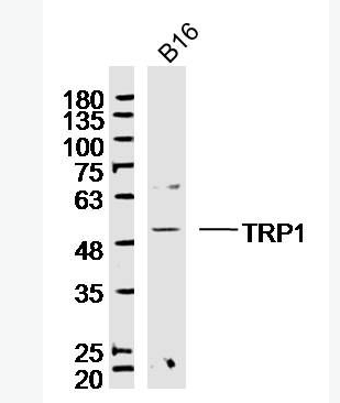 Anti-TYRP1 antibody-酪氨酸酶相关蛋白1抗体