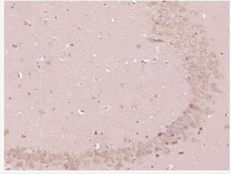 Anti-HO-1 antibody-血红素氧合酶 1/热休克蛋白32抗体