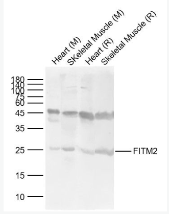 Anti-FITM2  antibody-FITM2蛋白抗体