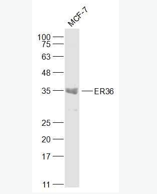 Anti-ER36 antibody-雌激素受体α36抗体