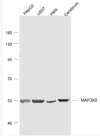 Anti-MAP3K8 antibody-丝裂原活化蛋白激酶激酶8抗体