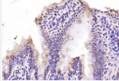 Anti-AHR antibody-芳香烃受体抗体