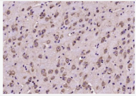 Anti-Notch 2 antibody-跨膜受体蛋白Notch-2抗体