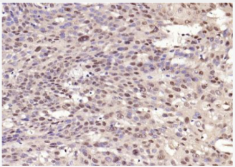 Anti-c-fos antibody-c-fos抗体.