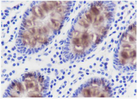 Anti-MUC2 antibody-粘蛋白-2/上皮膜抗原2抗体