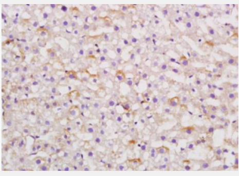 Anti-Angiotensinogen antibody-血管紧张素原抗体