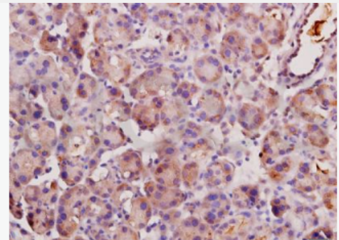 Anti-Angiotensin II antibody-血管紧张素Ⅱ抗体