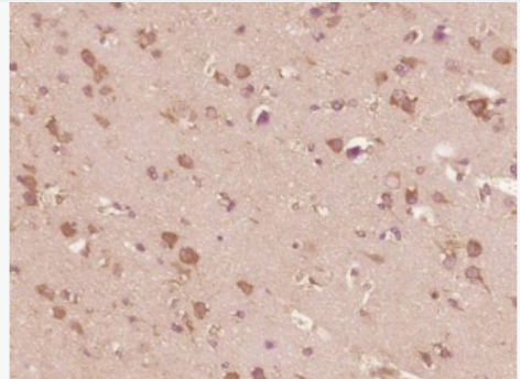 Anti-IL13 antibody-白介素13抗体