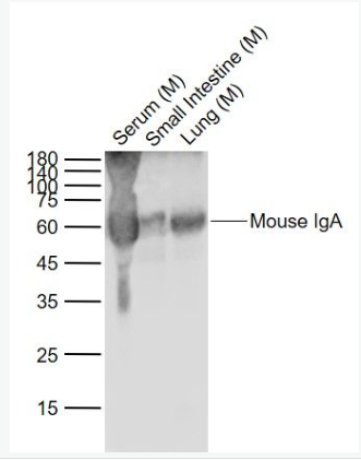 Anti-Big endothelin-1 antibody-内皮素1抗体