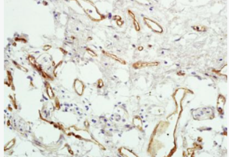Anti-PAR4 antibody-蛋白酶活化受体4抗体