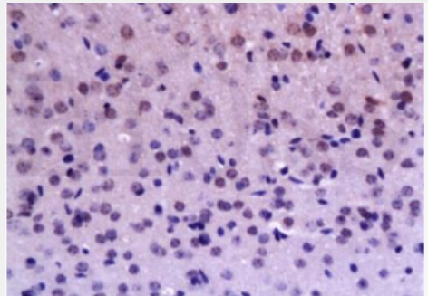 Anti-BrdU(Proliferation Marker) antibody-5-溴脱氧尿嘧啶核苷（增殖标志物）抗体