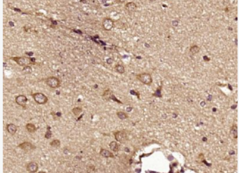 Anti-HSL/LIPE antibody-荷尔蒙敏感脂肪酶抗体