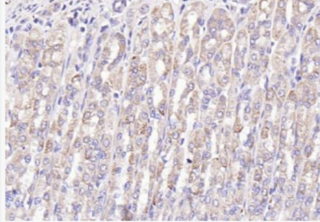 Anti-Gastrin antibody-胃泌素/蛙皮素抗体