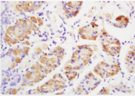 Anti-GRK2 antibody-G蛋白偶合受体激酶2抗体