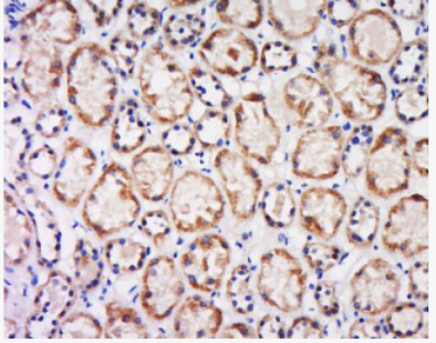 Anti-CX3CL1 antibody-CX3CL1抗体