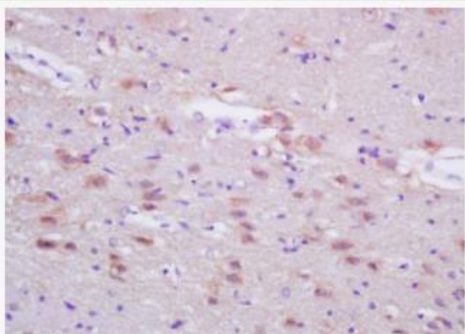 Anti-FASN antibody-脂肪酸合成酶抗体