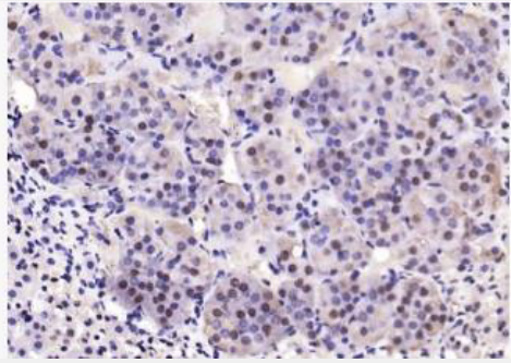 Anti-CK17 antibody-细胞角蛋白17抗体