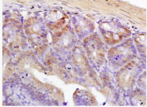 Anti-TCF7L2 antibody-转录因子7类似物2抗体