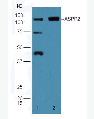 Anti-ASPP2 antibody-P53凋亡刺激蛋白2抗体