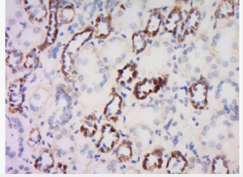 Anti-Defensin beta 2 antibody-防御素β2/Defensin β2抗体
