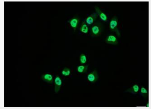 Anti-PDX1 antibody-胰岛素促进因子/胰十二指肠同源异型盒蛋白抗体
