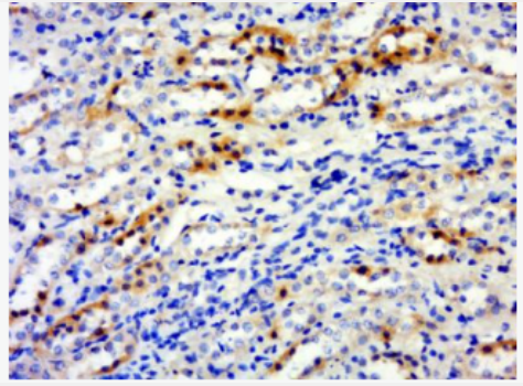 Anti-DAP5 antibody-死亡相关蛋白5抗体