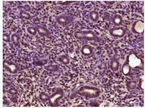 Anti-HIF1 beta antibody-缺氧诱导因子1β/HIF-1β抗体
