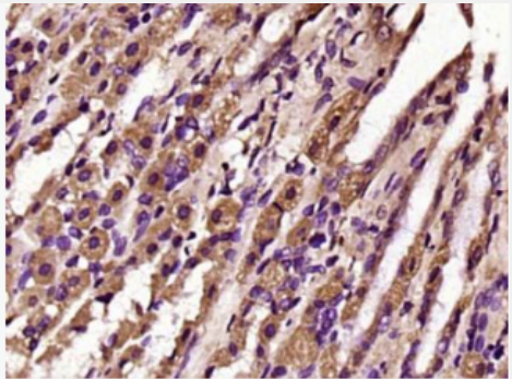 Anti-TOP2A antibody-DNA拓普西异构酶ⅡA抗体