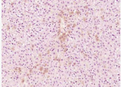 Anti-Reprimo antibody-细胞质内的糖基化蛋白抗体