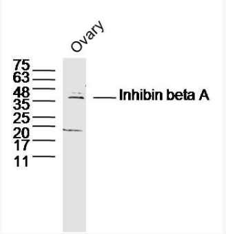 Anti-Inhibin beta A antibody-抑制素βA/Inhibin βA抗体