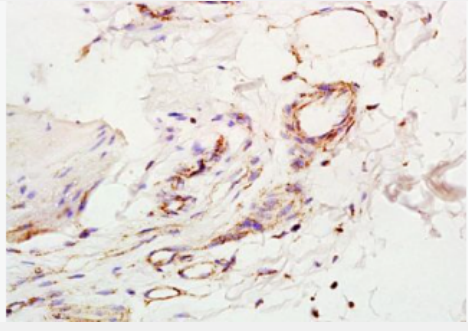 Anti-IL-2  antibody-白介素2抗体