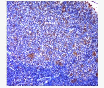 Anti-FDC-SP antibody-滤泡树突细胞分泌蛋白抗体